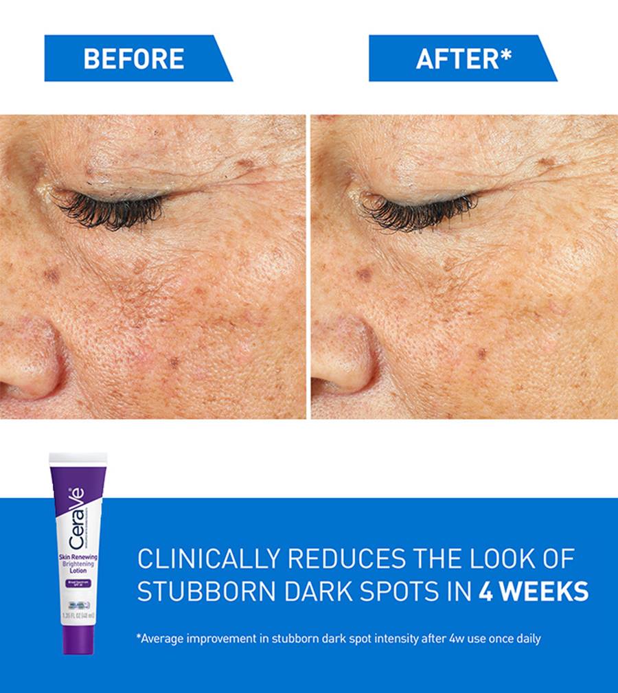 Skin Renewing Brightening Lotion with SPF 30